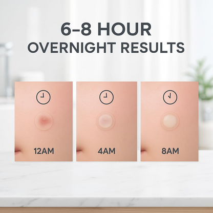 LE GUSHE Korean Pimple Patches for Face